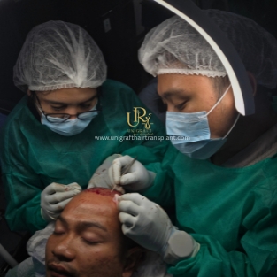 Ruang tindakan Unigraft
